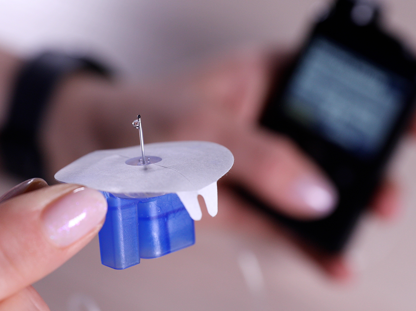 Правильный подбор канюли позволяет обеспечить стабильную подачу инсулина, комфорт при использовании инсулиновой помпы и минимизировать риски осложнений.